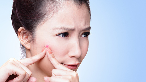 臉上長粉刺的原因為什么下巴處會起粉刺