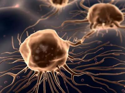 鼻子內(nèi)部如果出現(xiàn)腫瘤會(huì)有哪些癥狀