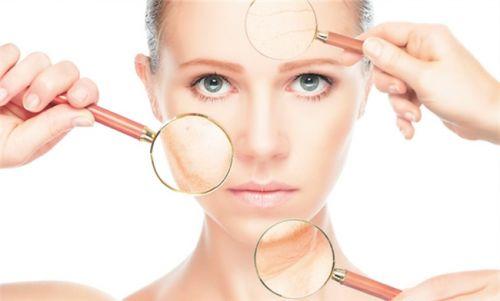 導致嘴唇周圍容易長痘的原因有哪些