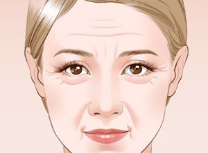 能夠有效去除面部皺紋的幾個(gè)方法