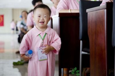 小孩患有唐氏綜合癥會有哪些明顯癥狀