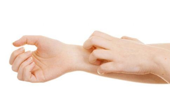 皮膚瘙癢的時候哪些藥膏止癢比較快