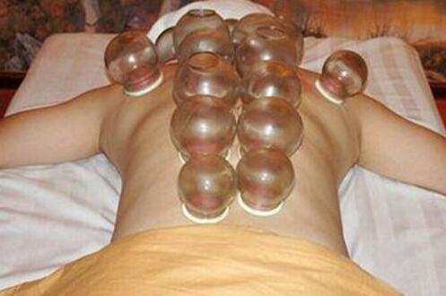 拔火罐的頻率控制在幾天拔一次最好-易網健康<a href=http://www.gyfww.com/jkys/ target=_blank class=infotextkey>養生</a>網 拔火罐的頻率控制在幾天拔一次最好