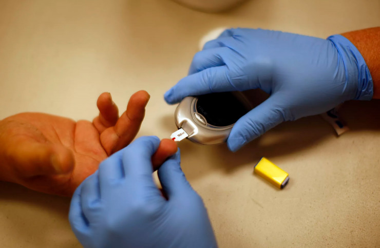 血糖高的孕婦應(yīng)該怎么吃每天的食譜