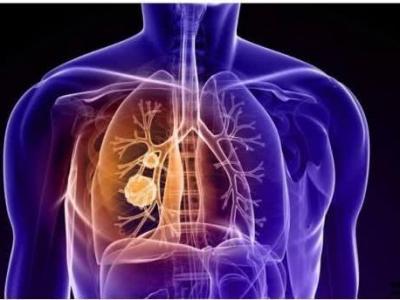 肺部功能的監(jiān)測(cè)分別監(jiān)測(cè)哪些方面