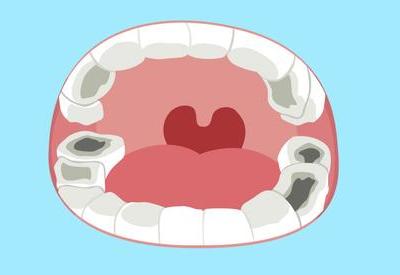 牙齒長了蛀牙自己要如何處理更好