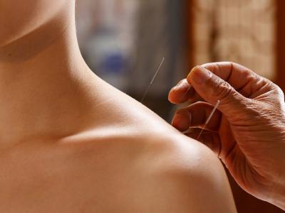 一天之內(nèi)適合針灸的時(shí)間段是什么時(shí)候