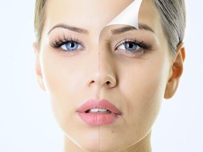 激光祛皺手術的原理以及激光祛皺手術的好處