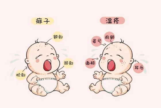 濕疹和蕁麻疹具體存在著哪些區(qū)別-易網(wǎng)健康<a href=http://www.gyfww.com/jkys/ target=_blank class=infotextkey>養(yǎng)生</a>網(wǎng) 濕疹和蕁麻疹具體存在著哪些區(qū)別