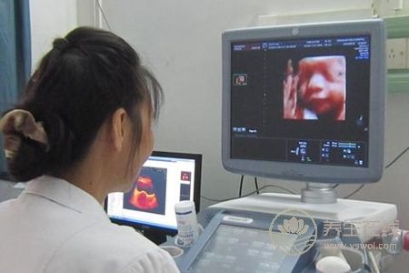 四維彩超有什么好處?四維彩超檢查什么?