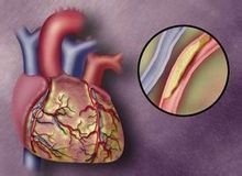 做好這三件事情可以讓你的甘油三酯指標降低