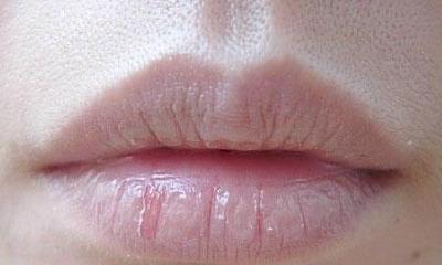 嘴唇經(jīng)常起皮常見因素可能與以下三種情況有關