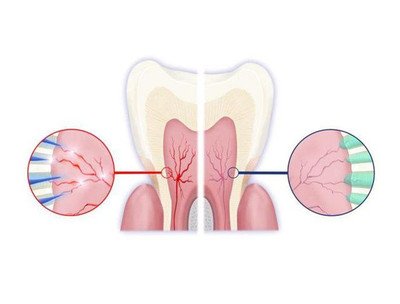 做好這六件事可以很好的預防牙齒敏感