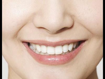 牙齦發炎的癥狀以及牙齦發炎的解決方法