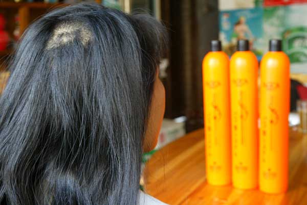 導致頭發變黃脫發的幾種常見原因