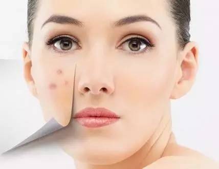 想要去除身體上的痘印應該吃什么