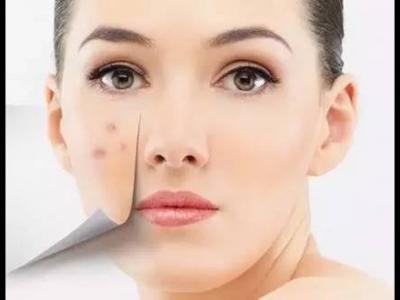 想要去除身體上的痘印應該吃什么