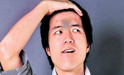 印堂指的是哪印堂發(fā)黑是疾病的征兆嗎