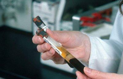 身體檢查性激素六項的標準值是多少