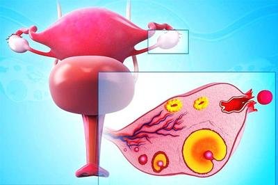常見的陰道炎分為哪幾大類如何治療陰道炎
