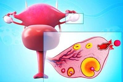常見的陰道炎分為哪幾大類如何治療陰道炎