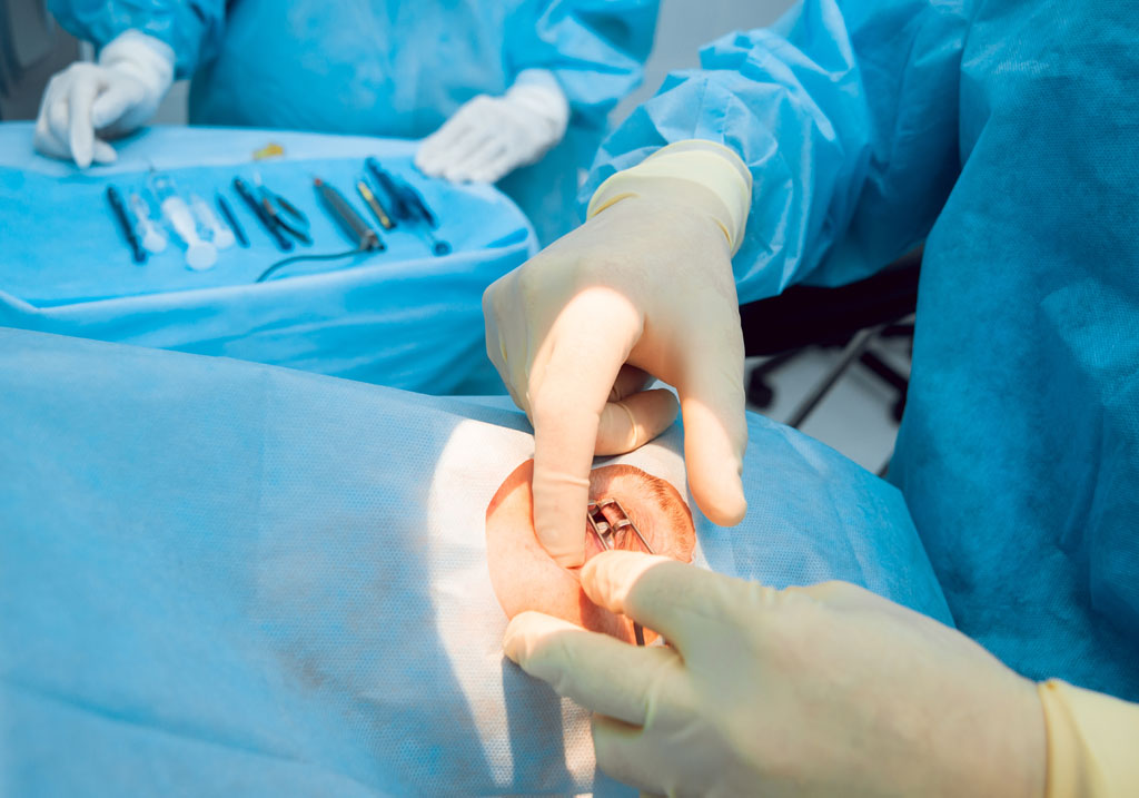 準(zhǔn)分子和飛秒哪種手術(shù)方式的對(duì)眼睛更好-易網(wǎng)健康<a href=http://www.gyfww.com/jkys/ target=_blank class=infotextkey>養(yǎng)生</a>網(wǎng) 準(zhǔn)分子和飛秒哪種手術(shù)方式的對(duì)眼睛更好