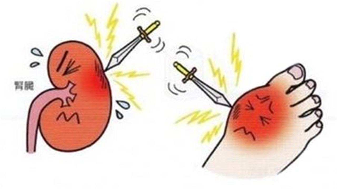 身體沒有出現(xiàn)這五個(gè)表現(xiàn)說(shuō)明你腎臟不錯(cuò)