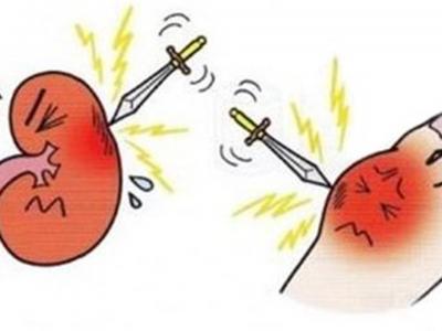 身體沒有出現(xiàn)這五個(gè)表現(xiàn)說明你腎臟不錯(cuò)