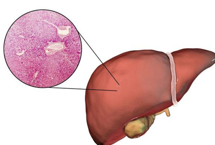 肝臟不好的人早晨起床會(huì)有這六個(gè)癥狀-易網(wǎng)<a href=http://www.gyfww.com/ target=_blank class=infotextkey>健康養(yǎng)生</a>網(wǎng) 肝臟不好的人早晨起床會(huì)有這六個(gè)癥狀