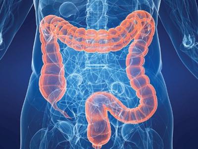 如果你出現這三個異常說明有可能是腸癌