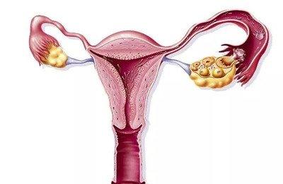 導致卵巢提前走向衰老的原因有哪些