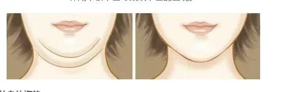 減雙下巴的運(yùn)動方式