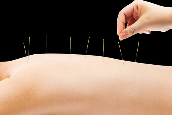 針灸的作用