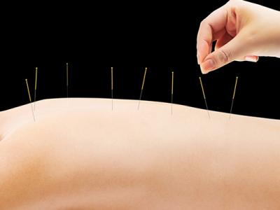 針灸的作用