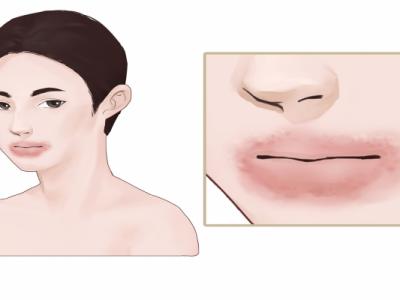 海鮮過敏的人能吃小龍蝦嗎 海鮮過敏的人適合吃什么食物