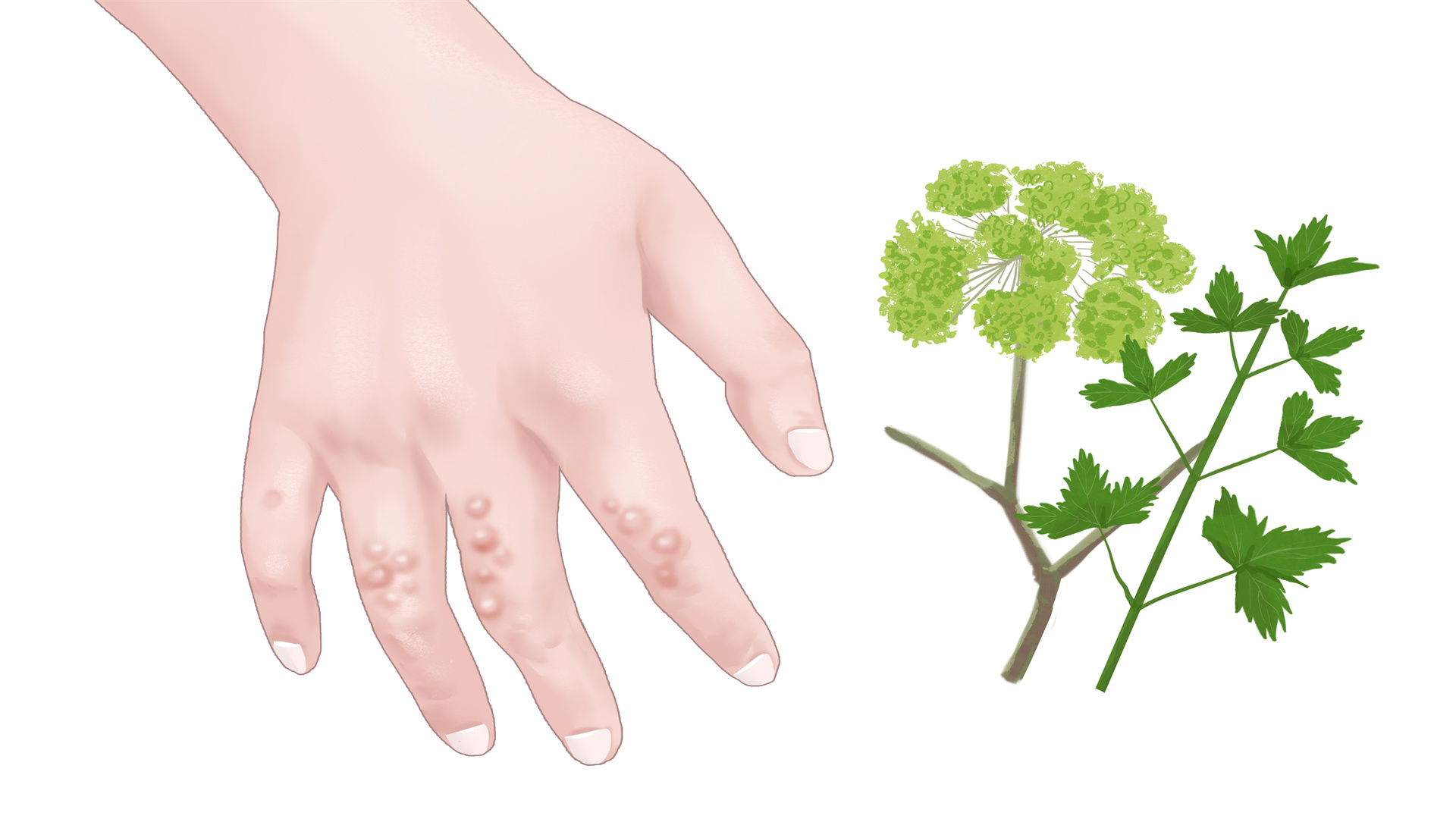 祛濕茶有必要每天喝嗎 濕氣重的具體表現(xiàn)