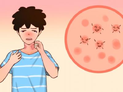 三伏天怎么去除體內濕氣 三伏天養生五大要點