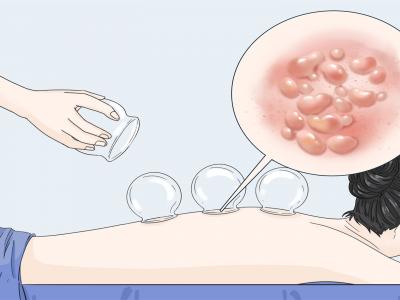 身體祛濕的最好方法有哪幾種 濕氣重人們?nèi)绾握{(diào)理