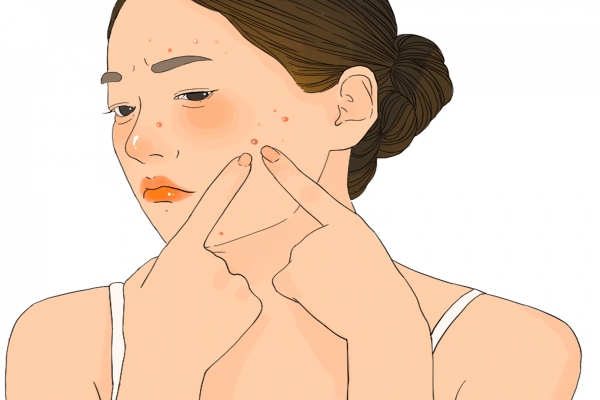 體寒卻肝火旺臉上總長(zhǎng)痘怎么調(diào)理 寒濕臉上長(zhǎng)痘還是濕熱長(zhǎng)痘