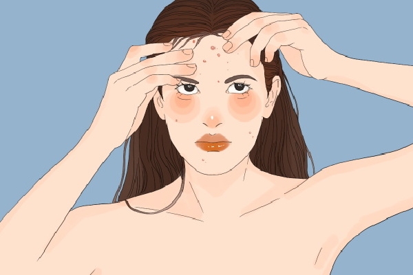 體寒卻肝火旺臉上總長(zhǎng)痘怎么調(diào)理 寒濕臉上長(zhǎng)痘還是濕熱長(zhǎng)痘