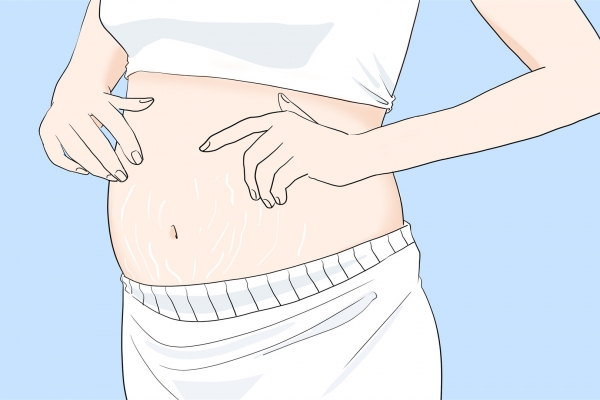 體內濕氣重會影響懷孕嗎 孕婦濕氣重會影響胎兒嗎