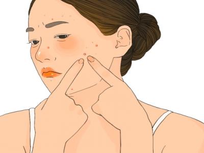 體寒卻肝火旺臉上總長痘怎么調理 寒濕臉上長痘還是濕熱長痘