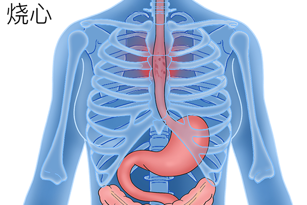 食管炎能不能吃蘭花豆