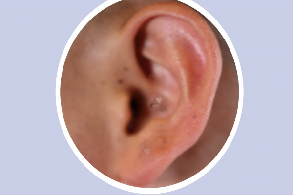 耳朵后面突然鼓起一個硬包