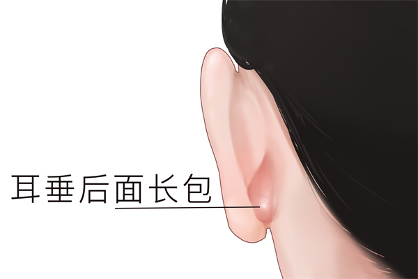耳朵后面突然鼓起一個硬包
