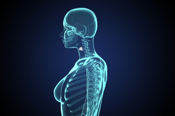 什么是橋本甲狀腺炎