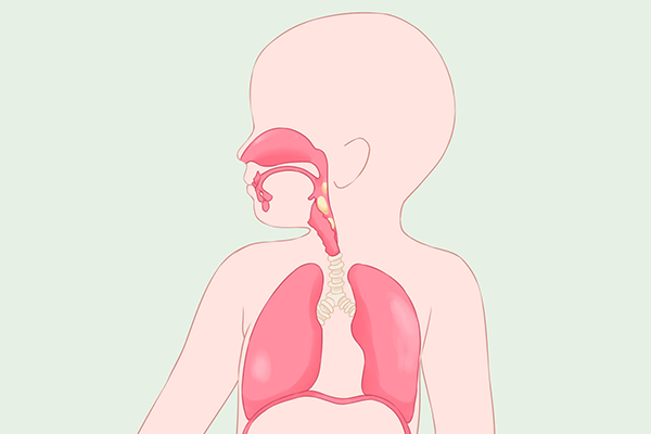 得了痙攣型腦癱會有哪些癥狀