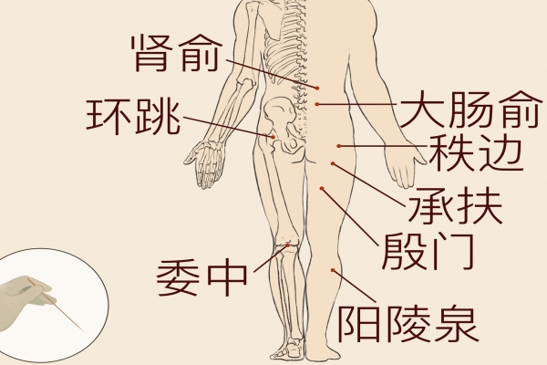 哪些中藥治療腰間盤突出