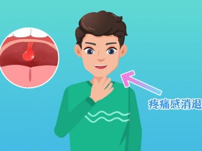 扁桃體炎是什么癥狀