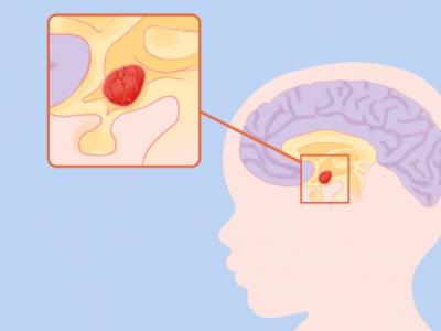 吃什么補腦增強記憶力